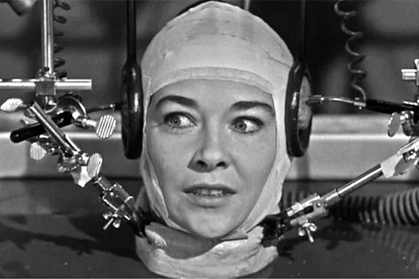 Greffer une tête humaine pourrait être possible d’ici deux ans !