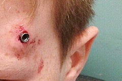 Un jeune footballeur de 11 ans miraculé après avoir reçu un projectile en pleine tête