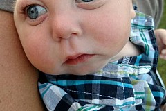 Etats-Unis: Jaxon, un bébé né sans crâne, émeut le Web