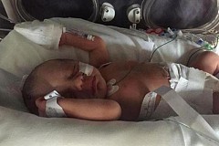 (Photos) Né avec des organes à l'extérieur de son corps, ce bébé lutte pour sa vie mais a retrouvé le sourire 