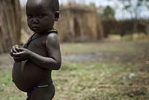 Plusieurs morts dues à la malnutrition dans le nord du pays
