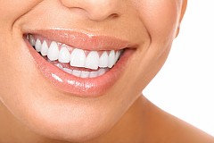 Bien être : Les dents blanches