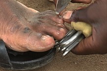 Coupeurs d’ongles ambulants, le métier nourrit son homme