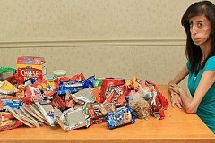 A 24 ans, elle ne pèse que 26 kilos A 24 ans, elle ne pèse que 26 kilos