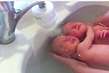 (VIDEO) A peine nés, les jumeaux ne veulent pas se décoller l'un de l'autre
