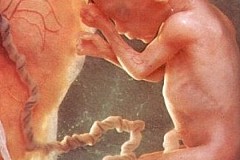 L'homme un aliment qui se consomme ? Des foetus humains dans la nourriture et les vaccins.