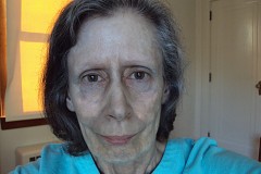 Après avoir pris des gouttes pour le nez, son visage a pris une teinte argentée Après avoir pris des gouttes pour le nez, son visage a pris une teinte argentée
