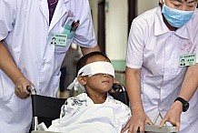 Guo, le petit garçon chinois énucléé est sorti de l'hôpital.