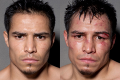 10 photos de boxeurs avant et surtout après leur combat.