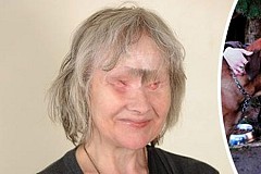 (VIDÉO): Son chien lui dévore le visage mais lui sauve la vie ! (VIDÉO): Son chien lui dévore le visage mais lui sauve la vie !