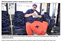 Son scrotum pèse 60 kg : «Je me sens prisonnier de mes testicules» Son scrotum pèse 60 kg : «Je me sens prisonnier de mes testicules»