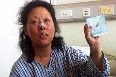 Dix ans de migraine à cause d'une balle logée dans la tête Dix ans de migraine à cause d'une balle logée dans la tête