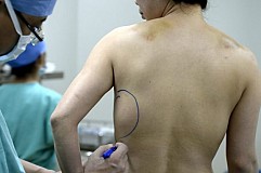 Cette Chinoise retrouve ses prothèses mammaires dans son dos et sur son ventre

