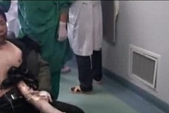 Il se fait transpercer le corps par un pieu en bois et survit Il se fait transpercer le corps par un pieu en bois et survit