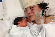 Dans le coma, elle met au monde son bébé et survit !