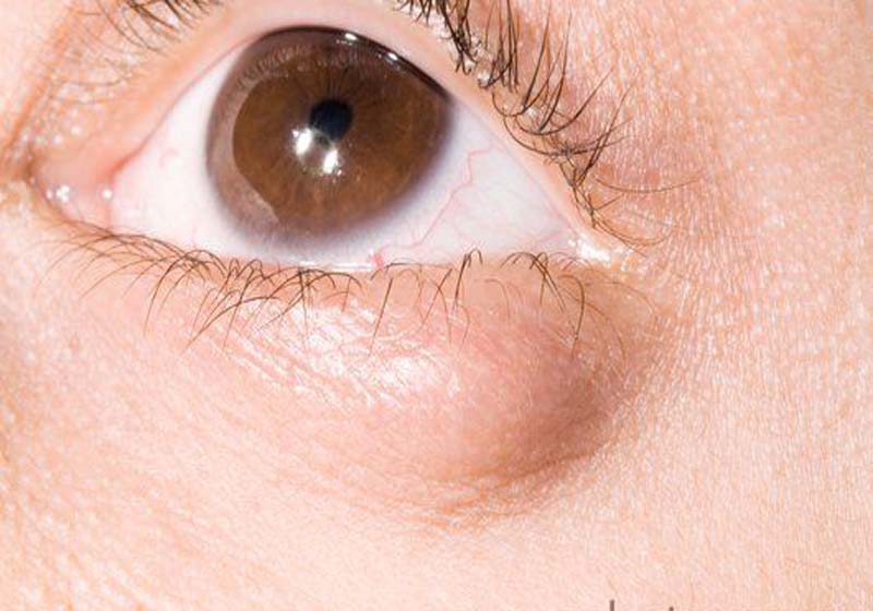 Meibomus des glandes indispensables aux larmes