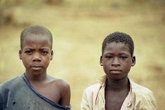 Divo: Un garçonnet de 7 ans amputé des yeux Divo: Un garçonnet de 7 ans amputé des yeux