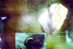 Abobo : Une mère de famille arrache l’oreille d’une jeune fille avec ses dents Abobo : Une mère de famille arrache l’oreille d’une jeune fille avec ses dents