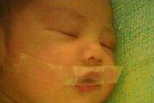 (vidéo) Une infirmière place un morceau de papier-collant sur la bouche d'un bébé pleurant trop fort 