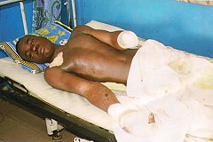 Gagnoa: Une grenade ampute un homme Gagnoa: Une grenade ampute un homme