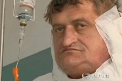 (Vidéo) Les médecins lui retirent 6 kilos de tumeur au visage