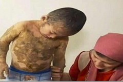 À 5 ans, sa peau est couverte d'écailles à cause d'une rare maladie: «Je ne veux plus qu'on m'appelle le lézard»