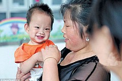 (Photos) Ce pauvre bébé abandonné par sa mère doit vivre avec une tumeur de la taille d'un melon