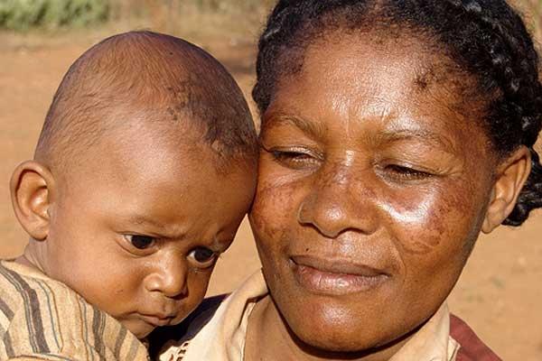 Traumatismes : comment la mère les transmet à l’enfant