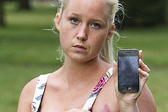 (Photos) L'iPhone de cette jeune femme a brûlé sur son sein gauche alors qu'elle dormait (Photos) L'iPhone de cette jeune femme a brûlé sur son sein gauche alors qu'elle dormait