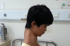 (photos) Ce chinois possède le plus long « cou » du monde 