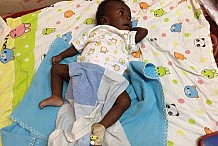 (photos) Ouganda: Ce bébé est né avec quatre bras et quatre jambes! 