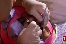 (vidéo) Pour ne pas payer le dentiste, il arrache lui-même... la dent de sa femme! 
