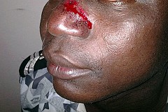 (Côte d' Ivoire) Lutte contre les CD piratés: Des policiers de la brigade culturelle bastonnés à Abobo (Côte d' Ivoire) Lutte contre les CD piratés: Des policiers de la brigade culturelle bastonnés à Abobo