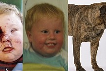 Un enfant de 2 ans défiguré par un Bullmastiff