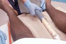 Cet homme file aux urgences car il a le manche d'une pelle coincé… dans le rectum