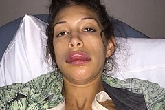 (Photos) Farrah Abraham et son opération ratée des lèvres (Photos) Farrah Abraham et son opération ratée des lèvres