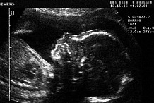 Hong Kong : Un nouveau-né... enceinte