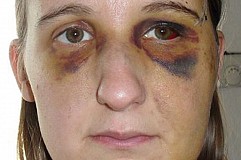 La justice l'oblige à correspondre avec l'homme qui l'a battue La justice l'oblige à correspondre avec l'homme qui l'a battue