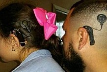Pour soutenir sa fille sourde, ce père se fait tatouer un appareil auditif sur le crâne