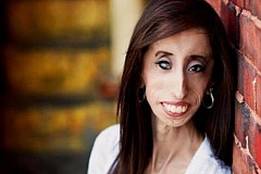 Détestée pour son physique elle inspire un film contre le harcelement Détestée pour son physique elle inspire un film contre le harcelement