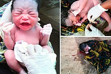 (Photos) Une femme donne naissance à un bébé en pleine rue.