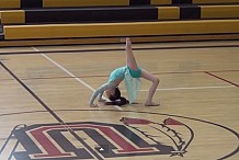 (Vidéo) Après une amputation, une petite fille danse avec une prothèse