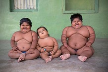 (Photos) Inde: Un père désespéré souhaite vendre ses reins pour financer le traitement de ses enfants souffrant d'obésité morbide 