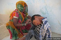Mahendra, 12 ans, vit un enfer à cause d'une maladie rare: Mahendra, 12 ans, vit un enfer à cause d'une maladie rare: