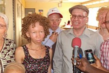 Production d'un film-documentaire de sensibilisation sur les Albinos 