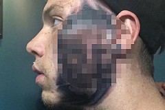 (Photos) Il se fait tatouer le visage de son fils sur la joue 