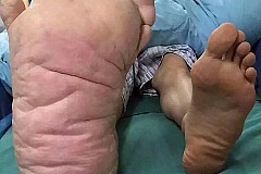(Photos) Chine: Il possède un pied plus gros que l'autre.... (Photos) Chine: Il possède un pied plus gros que l'autre....