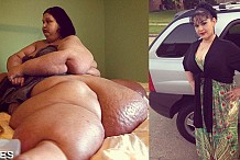 (Photos) Elle perd plus de 350 kilos et retrouve une forme incroyable