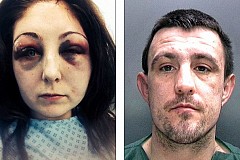 (Photos) Tabassée par un ami fou de jalousie alors qu'elle porte son bébé de 22 mois dans les bras (Photos) Tabassée par un ami fou de jalousie alors qu'elle porte son bébé de 22 mois dans les bras