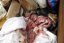 Yopougon: Le corps d'un nouveau-né enfermé dans un sachet